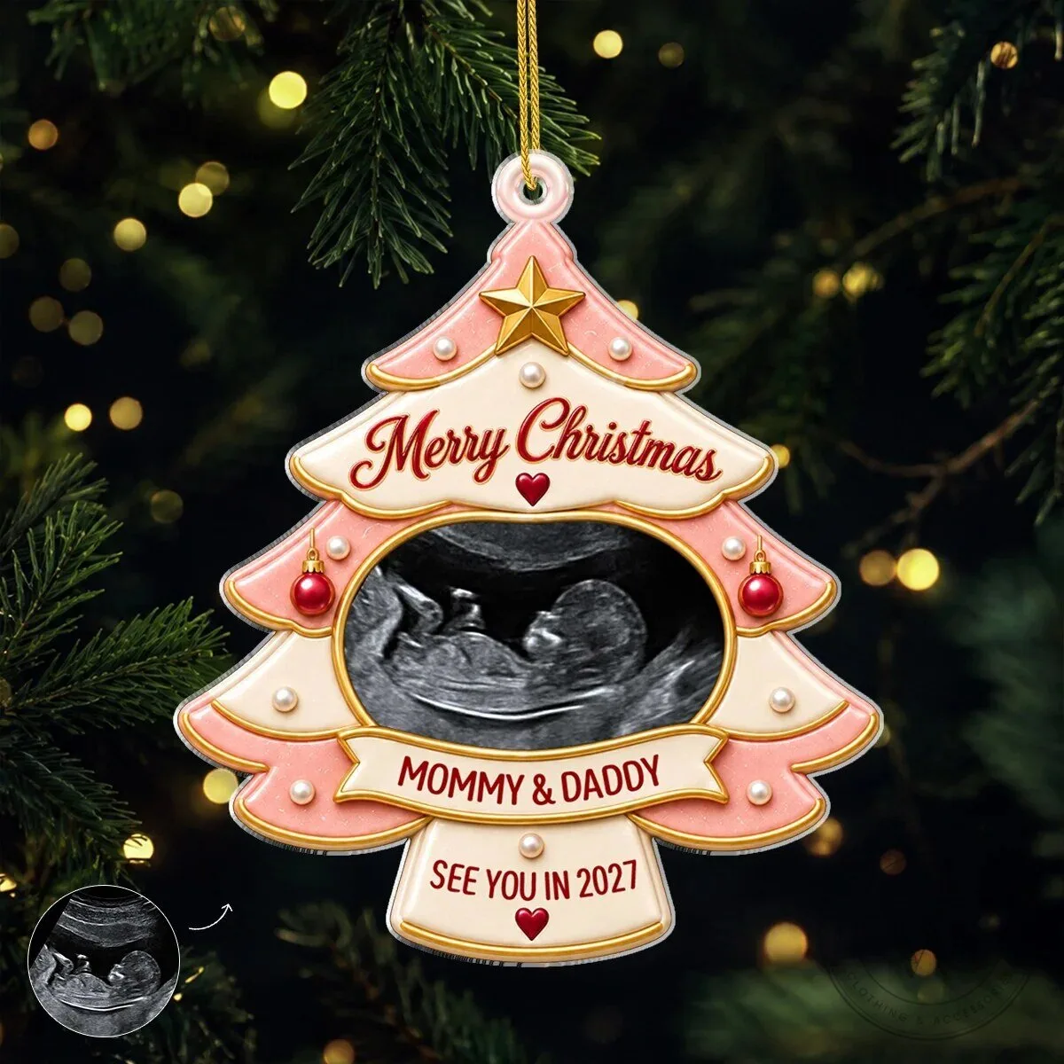 Personalized Ultrasound Photo Christmas Tree Ornament for Expecting Parents